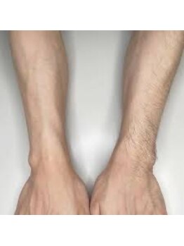 ビューメン(BYUMEN)/女性が見ている男性のツルすべ腕