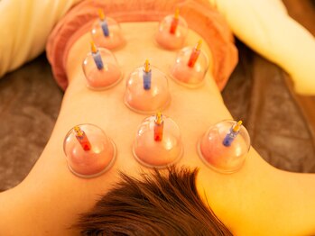 三福七/カッピング