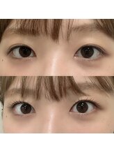 ミリ 奈良駅店(mm)/Before→After