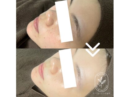 ハルミ美容整体 川口店(Harumi美容整体)の写真