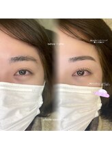 ボニー(BONNY)/まゆげ × まつげ