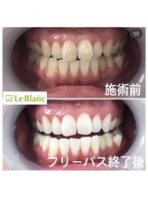 ルブラン 奈良店(Le Blanc)/沢山通ってお得に！