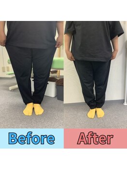 ほずみ整体院/Ｏ脚の施術