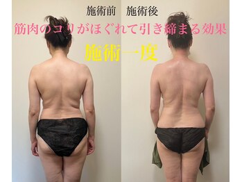 リセット(Reset.)/ビフォーアフター