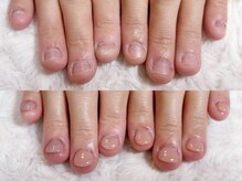 グレースレディ 大阪店/深爪/自爪育成/フィルイン