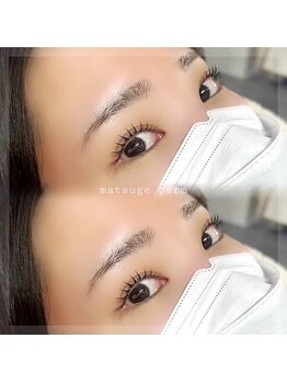 アムラット(amlat)/ぱっちりeye