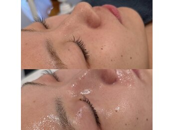 ロイヤル ビューティー サロン(Royal Beauty Saloon)/韓国発最新肌管理【セルマン】