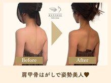 ラフリー 武蔵小杉院(RUFFREE)/正しい姿勢が最高の美容