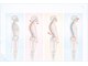 みなみ整骨院の写真/根本改善！【初回:骨盤矯正￥2980】心地よい手技のソフト整体で骨盤/肩甲骨/猫背のお悩み解消☆