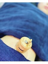 プロムナード(PROMENADE)/年中大人気なお灸