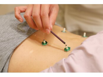 草加鍼灸院 整骨院/お灸もやっています!