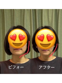 整体院りょう 高槻市/#顎関節調整 