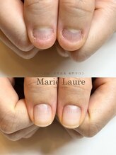 マリーロール 梅田店(Marie Laure)/深爪矯正/自爪育成/自爪風