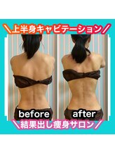 ビューティ ウィッチ(Beauty Witch)/