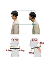 カイロ アンド エステカイロ 悠/ストレートネックになってんか？