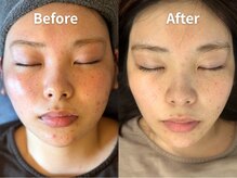 エヌ(N)の雰囲気（小顔矯正だけじゃない美肌づくりも◎恵比寿でお顔のお悩みはNへ）