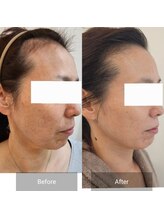 シンユウ(Shinyou)/ノーファンデーションを叶える！