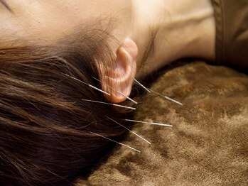 やぎおか堂/鍼灸