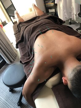 オカ鍼灸院(OKA鍼灸院)/