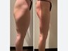 【12回集中コース】ハイパーナイフ小顔+選べる全身49800円→45000円