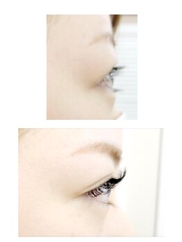 レセ(L’ce)/【ビフォーアフター】140本　　