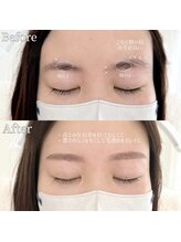 ピレンジ(Prange)/間引きとても重要です！