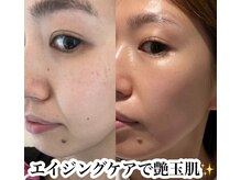 ネッコ 表参道店(necco)の雰囲気（ワンランク上のエイジングトリートメントで極上ハリツヤ肌！！）