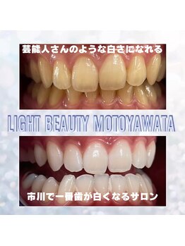 ライトビューティー 本八幡店(LIGHT BEAUTY)/お客様ビフォーアフター♪ 