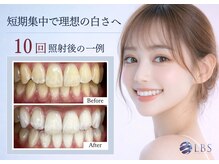 LBSホワイトニング 吉祥寺店