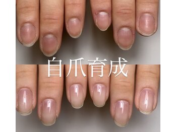 ロイヤル ネイルサロン(Royal nail Saloon)/4ヶ月後の変化