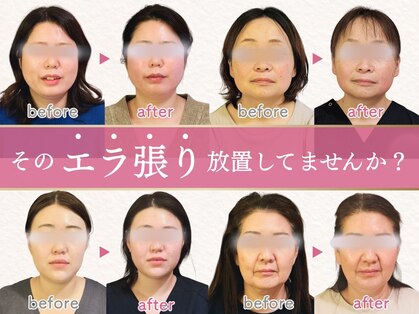 オルグル(OLGUL)の写真
