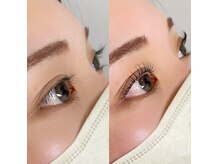 ムーン(moon)/ラッシュリフトでぱっちり！