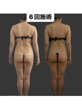 ステラ(Stella)/ブライダルのお客様