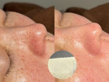 ルーナジェーナ(Luna llena)/池袋 エステ ルーナジェーナ