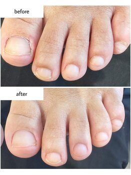 ケアプラス(care plus)/フットネイルケア