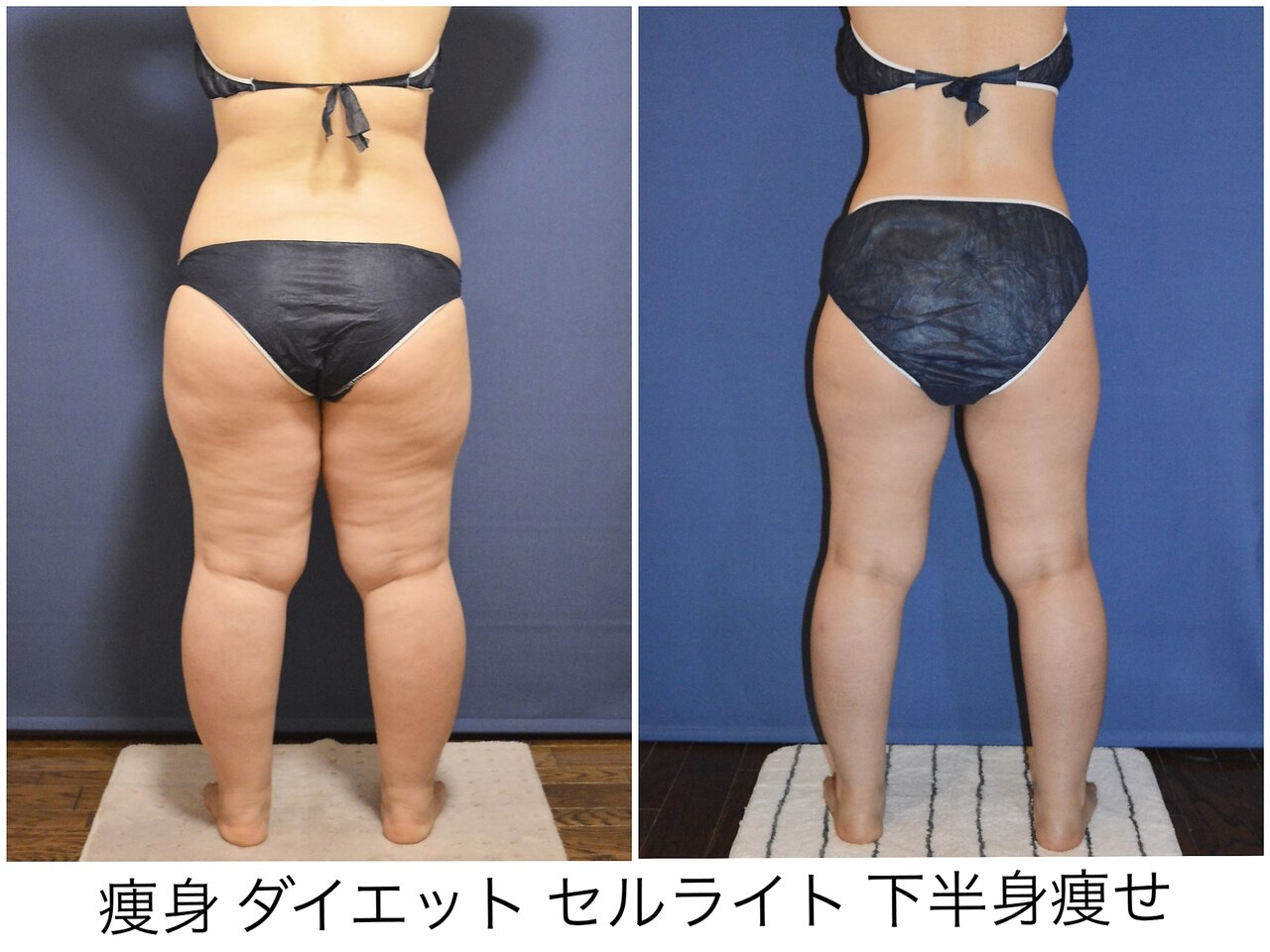 姫路駅でエンダモロジーが人気のエステサロン｜ホットペッパービューティー