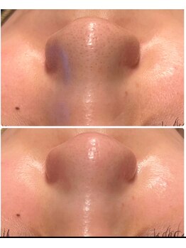 ヴェレン(Wellen)/ビフォーアフター