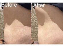 ディアーム 岸和田カンカン店(Diarm)/レッドショット