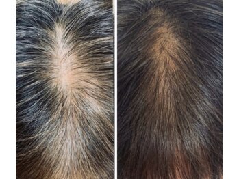 ユニクリア(Uni clear)/毛髪ケア