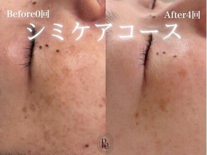 アールエーサロン 恵比寿 広尾(Ra salon)の写真