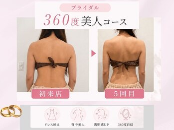 クラッシー(Classy)の写真/【1ヶ月4回／本気痩せコース】本気で痩せたい人限定。インナーケアセット付で腸内環境から整える。