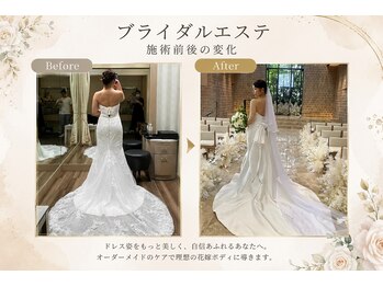 エノアボディ 品川店(ENOAH BODY)/#ブライダル メニューも大人気☆
