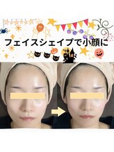 メディカルサロン かとれあ/おめでとうございます