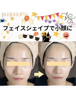 メディカルサロン かとれあ/おめでとうございます