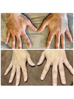 ルーチェ/【手の甲.指脱毛】隠れた人気!