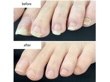 ケアプラス(care plus)の雰囲気（足元の清潔感は健康と美しさの基本。トラブル予防のケアにも）