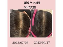 ビューティー アディクト(Beauty addict)/三浦半島初導入！頭皮ケア