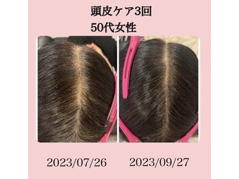 ビューティー アディクト(Beauty addict)/三浦半島初導入！頭皮ケア