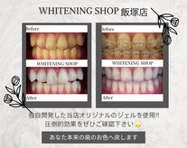 ホワイトニングショップ 飯塚店