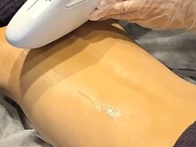 エン(En)/【キッズ脱毛カウンセリング】